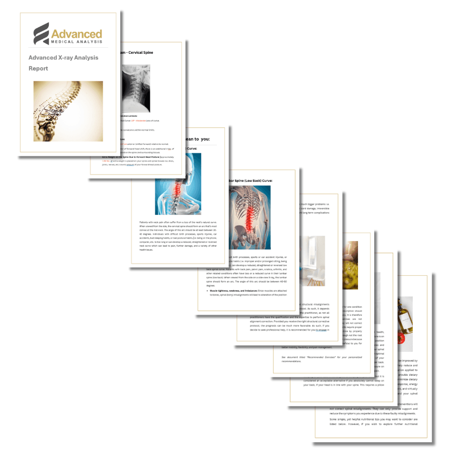 Sample pages from an Advanced X-ray Analysis report showing detailed spinal measurements and findings